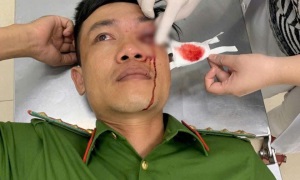 Bình Thuận: Đại úy 13win10 bị thương khi 13 win đối tượng ma túy trong đêm